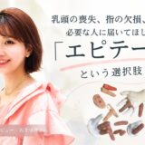 乳頭の喪失、指の欠損、小耳症。必要な人に届いてほしい「エピテーゼ」という選択肢