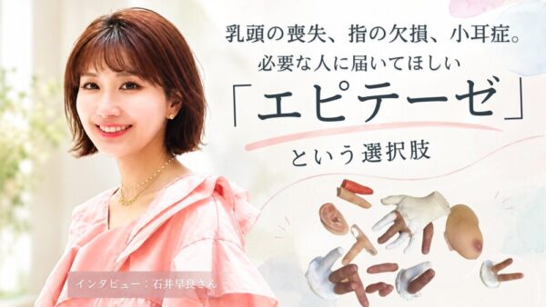 乳頭の喪失、指の欠損、小耳症。必要な人に届いてほしい「エピテーゼ」という選択肢
